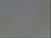 Testechiniscus laterculus image