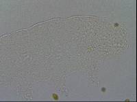 Hypsibius calcaratus image