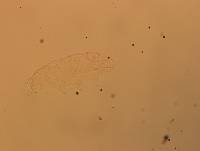Hypsibius calcaratus image