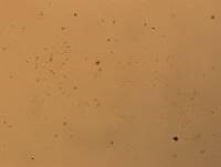 Hypsibius calcaratus image