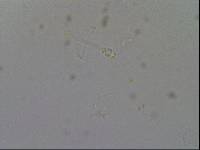 Hypsibius calcaratus image