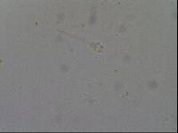Hypsibius calcaratus image