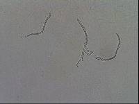Hypsibius calcaratus image