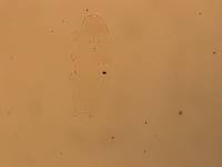 Hypsibius calcaratus image