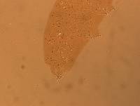 Hypsibius calcaratus image