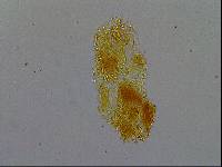 Hypsibius calcaratus image