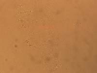 Hypsibius calcaratus image