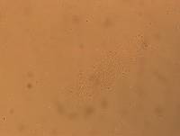 Hypsibius convergens image