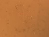 Hypsibius convergens image