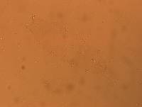 Hypsibius convergens image