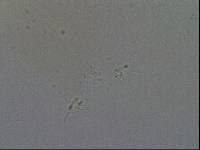 Hypsibius convergens image