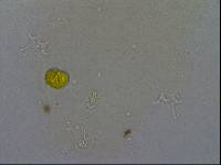 Hypsibius convergens image
