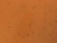 Hypsibius convergens image