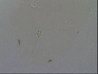 Hypsibius convergens image