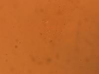 Hypsibius convergens image