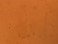 Hypsibius convergens image