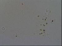 Hypsibius convergens image