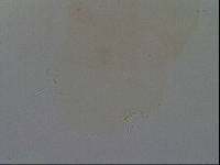 Hypsibius convergens image