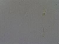 Diphascon chilenense image