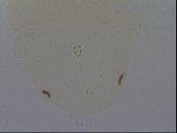 Hypsibius convergens image