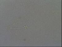 Hypsibius convergens image