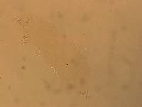 Hypsibius convergens image