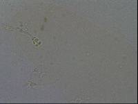 Hypsibius convergens image