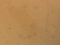 Hypsibius convergens image
