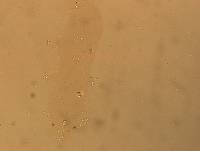 Hypsibius convergens image
