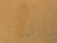Hypsibius convergens image