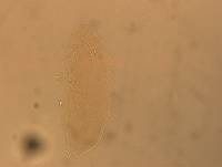 Hypsibius convergens image
