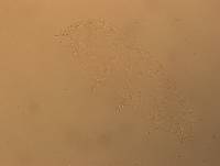 Hypsibius convergens image
