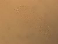 Hypsibius convergens image