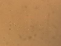 Hypsibius convergens image