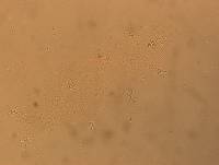 Hypsibius convergens image