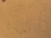 Hypsibius convergens image