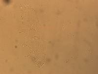 Hypsibius convergens image