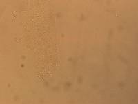 Hypsibius convergens image