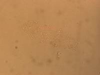 Hypsibius convergens image