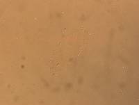 Hypsibius convergens image