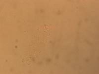Hypsibius convergens image