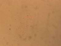 Hypsibius convergens image