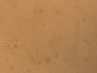Hypsibius convergens image