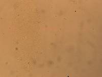 Hypsibius convergens image