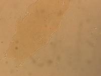 Ramazzottius oberhaeuseri image