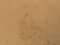 Ramazzottius oberhaeuseri image