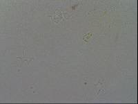 Hypsibius convergens image