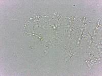 Calohypsibius ornatus image