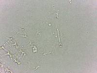 Calohypsibius ornatus image