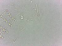 Calohypsibius ornatus image